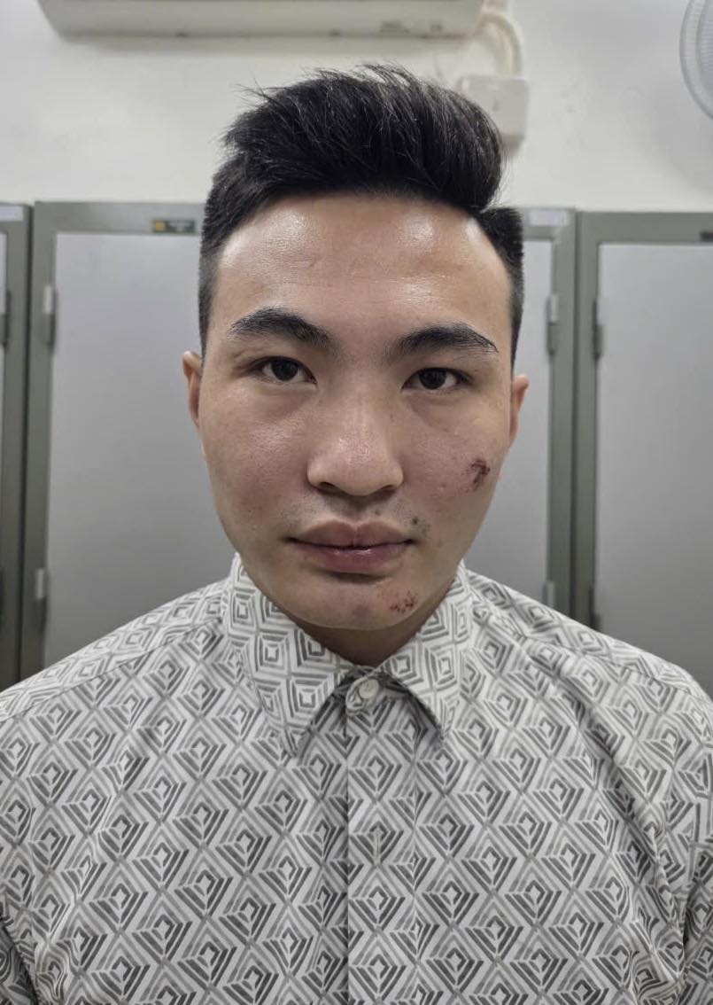 Hà Nội: Tạm giữ hình sự thanh niên vi phạm giao thông chống người thi hành công vụ tại chốt A80- Ảnh 1.