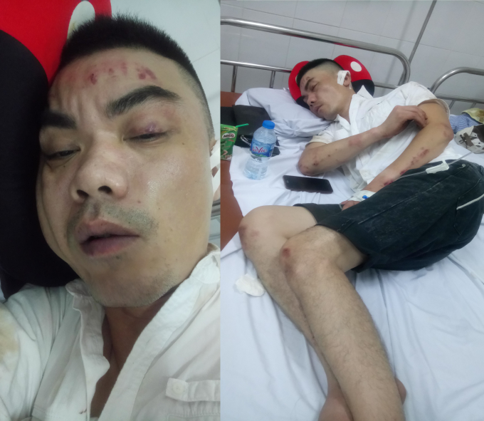 Anh Nguyễn Anh Hoàng - khách gửi xe tại bãi xe sai