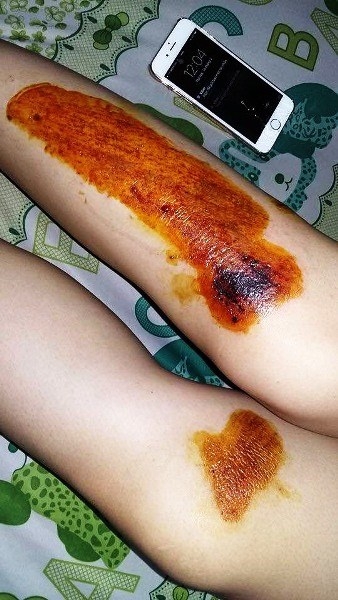 Á quân The voice 2015 bị cướp kéo lê trên