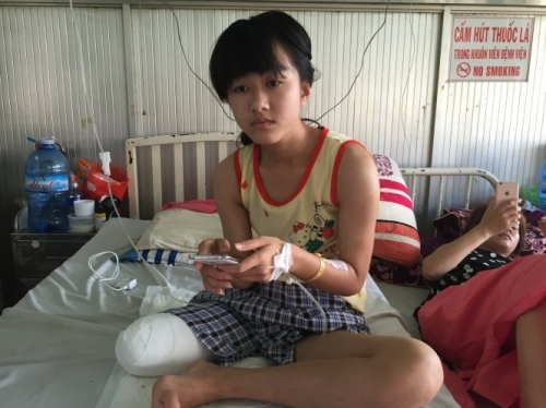 Nữ sinh bị cưa chân- Bác sỹ lý giải nguye