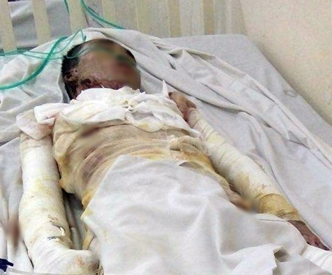 Hút thuốc trong lúc sửa xe, chàng trai trẻ