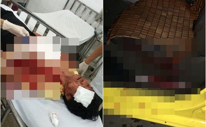 Táo tợn đâm tài xế taxi gần 10 nhát, cướp tài sản 