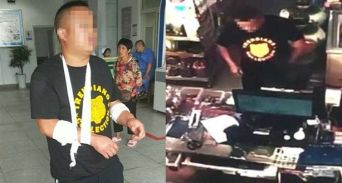 2 Tự cắt tay để không phải mua siêu xe cho bạn gái