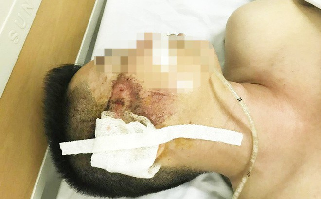 photo-1-15410329700852051097690