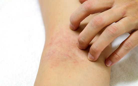 photo-1-1544629674575386647078