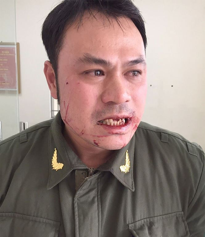 photo-1-15472168745321901742122