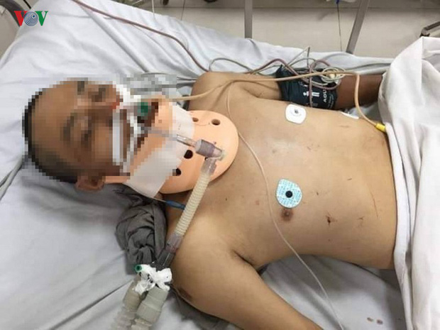 photo-1-1565237447978357793518