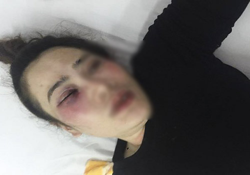 tim-mat-4606-1527642853