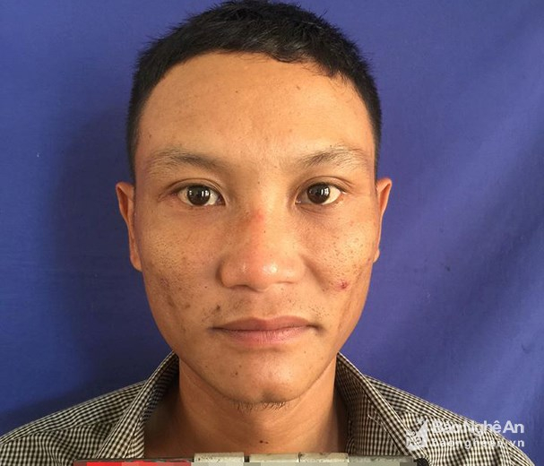 bna_trom_31859725_2772018