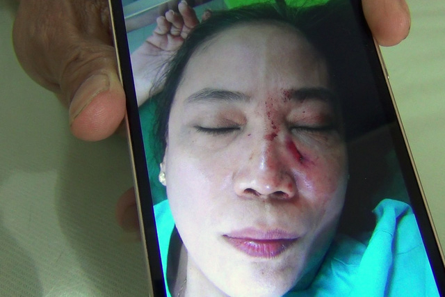 coduyen-1-1543657047626401468655