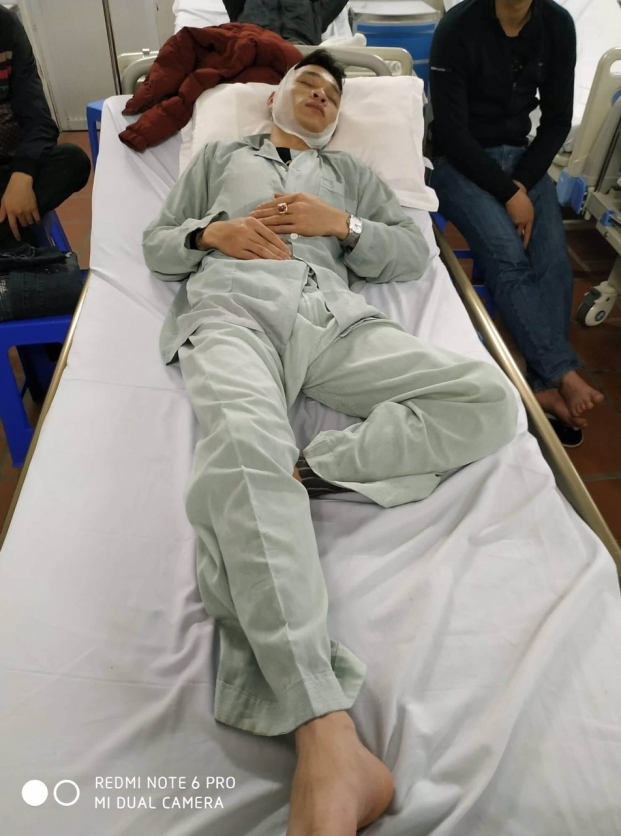 tai-xe-mazda-3-bi-chem-toac-dau-1452