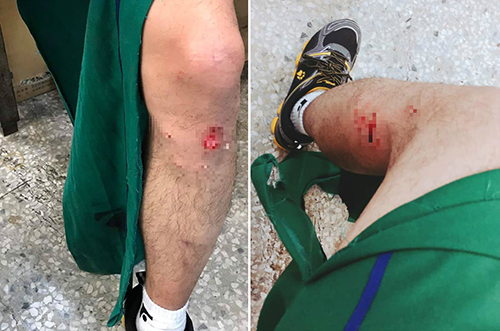 cho-pitbull-can-1-4885-1558137217