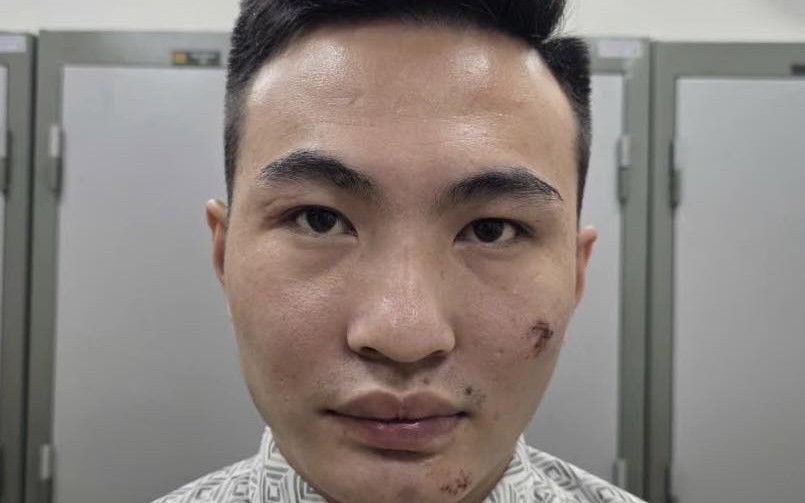 Hà Nội: Tạm giữ hình sự thanh niên vi phạm giao thông chống người thi hành công vụ tại chốt A80